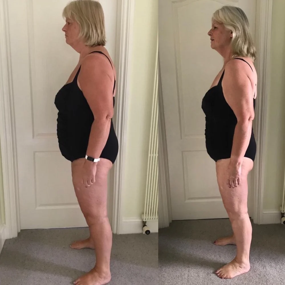 Client wellbeing progress shown in side-by-side photographs